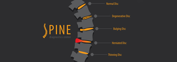 Chiropractic Lexington KY Back Pain Disc Illustration